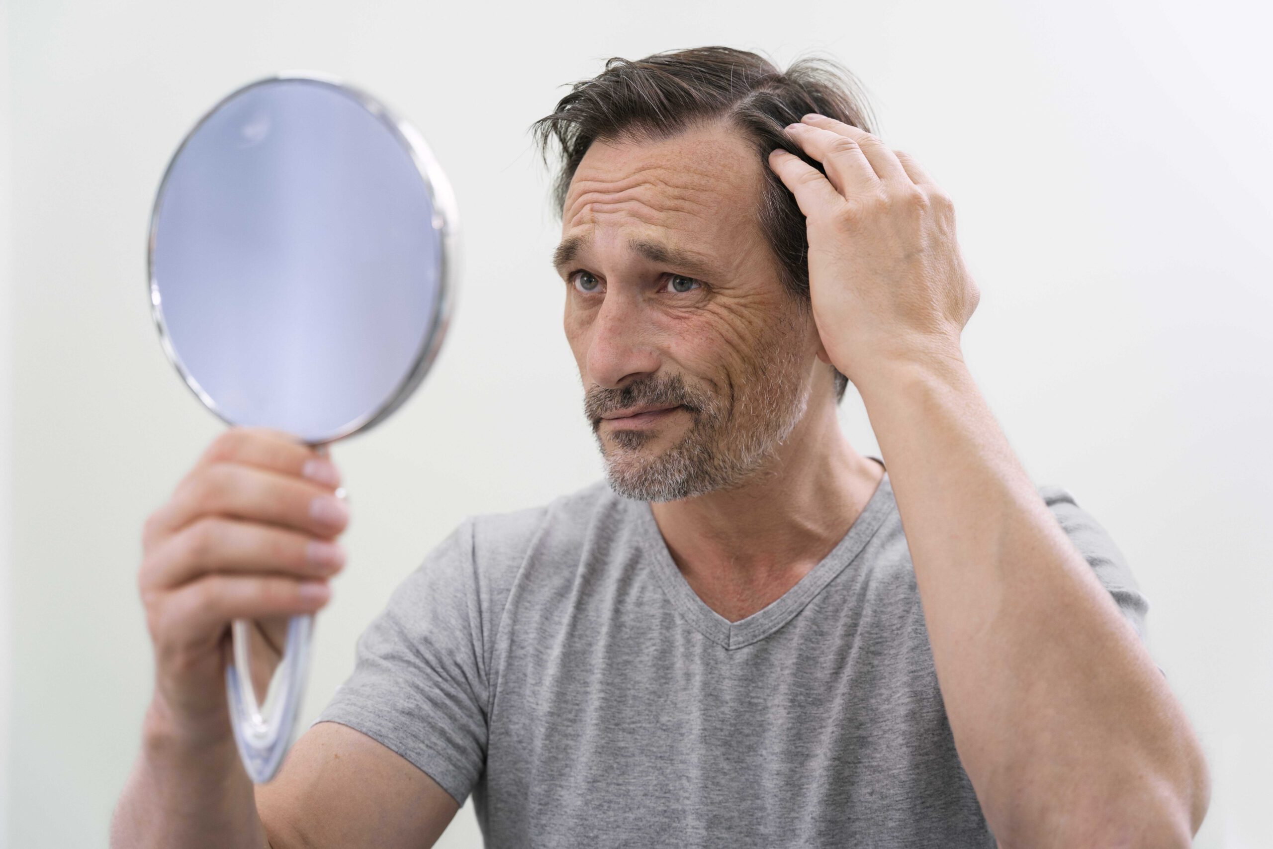 נשירת שיער אצל גברים – למה זה קורה ומה הפתרון?
